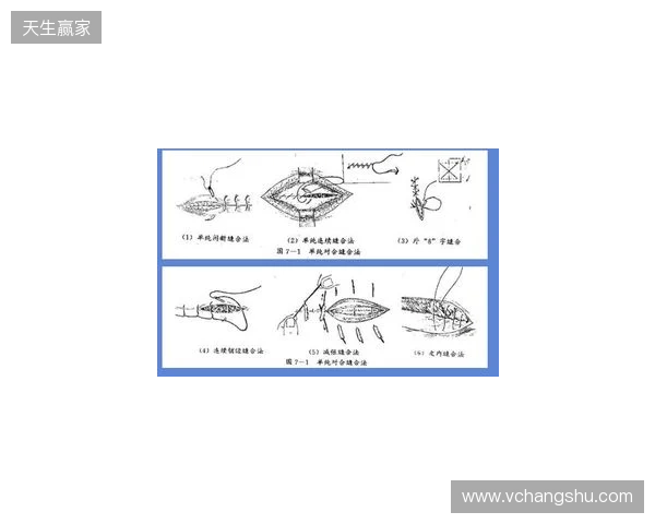 广州豹官方：杨浩眉弓伤口缝合30余针，预计5-7天后拆线